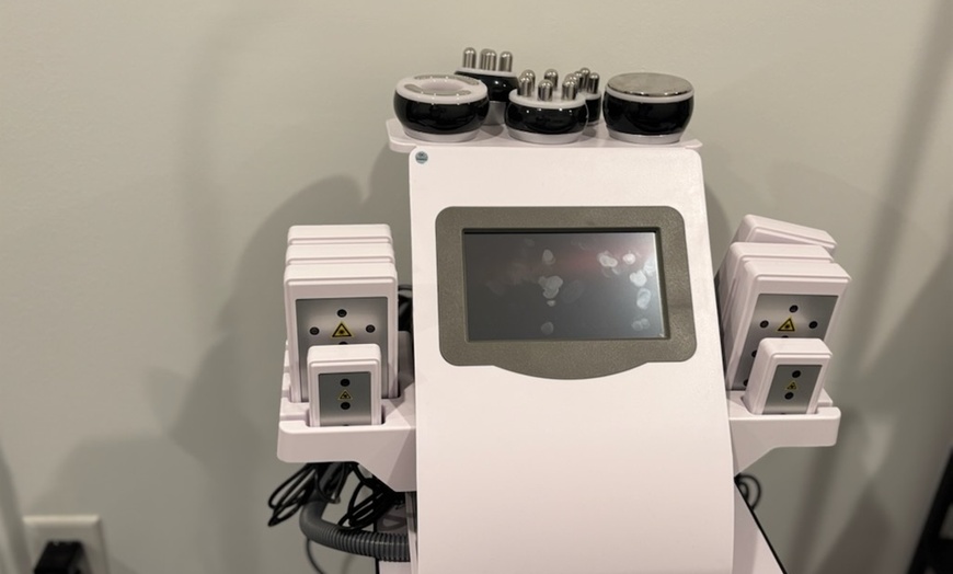 Image 5: RF Skin Tightening – Firm & Smooth Skin with No Downtime