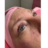 Image 3: One Eyelash Lift w/ a choice of Tinting Treatment