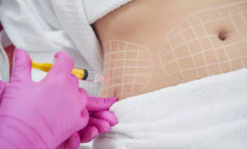 Image 1: One Session of Aqualyx Fat-Dissolving Injection for Tummy & More