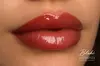 Up to 45% Off on Lip Enhancement at Blaké Aesthetics