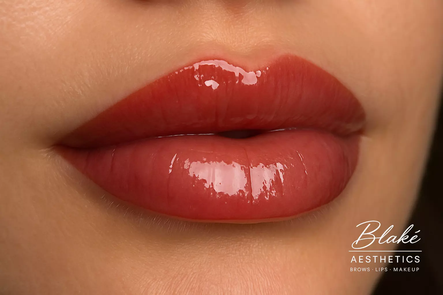 Up to 45% Off on Lip Enhancement at Blaké Aesthetics - Primary Image