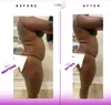 Transform your body with Four or Eight Ultrasonic-Cavitation Sessions at UnIque Bodies 360- Up to 58% Off