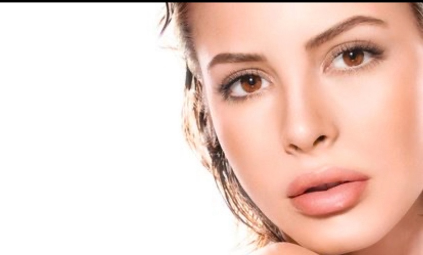 Image 1: Smooth Out Fine Lines with Botox or Juvéderm (Up to 62% Off)