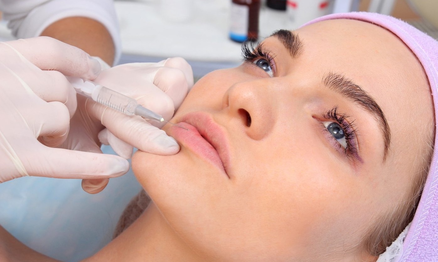 Enhance Lips with Juvederm Ultra XC Lip Filler and Restylane Kysse 