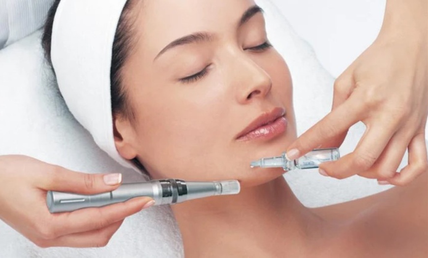 Image 2: Refresh your skin w/ 1 or 3 Micro-Needling Hyaluronic Acid Treatment 