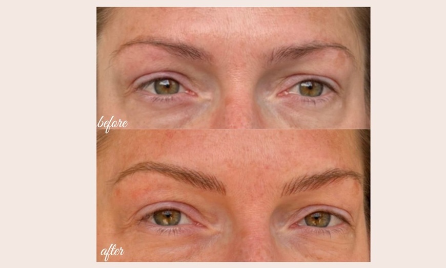 Image 9: Defined Brows & Lips with Microblading or Lip Blush