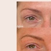 Image 9: Defined Brows & Lips with Microblading or Lip Blush