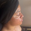 Image 2: Up to 36% Off on Facial at Ink'D Esthetics