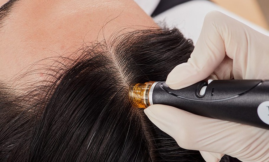 Image 3: 60 or 90-Min Dry Head Spa: Scalp Treatment, Hair Growth Serum & More