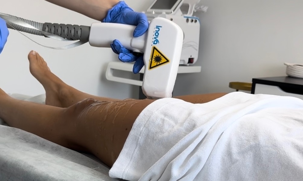 Get Smooth Skin with Six Laser Hair-Removal Sessions