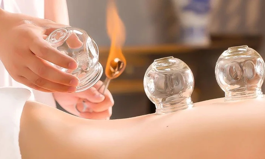 Image 5: Holistic Healing with Acupuncture or Fire Cupping + Biofeedback