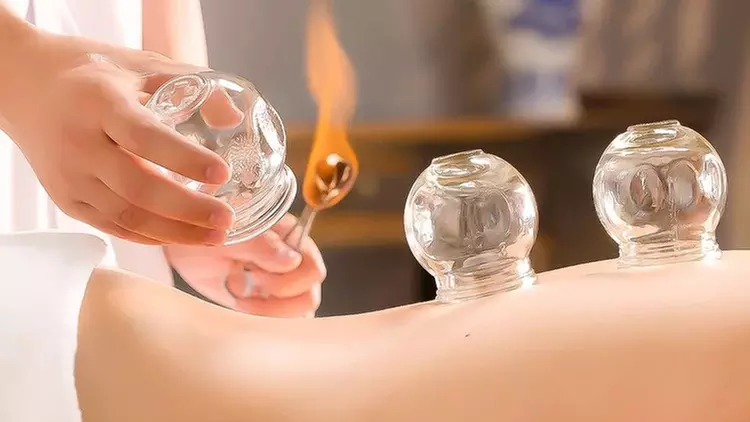 Holistic Healing with Acupuncture or Fire Cupping + Biofeedback