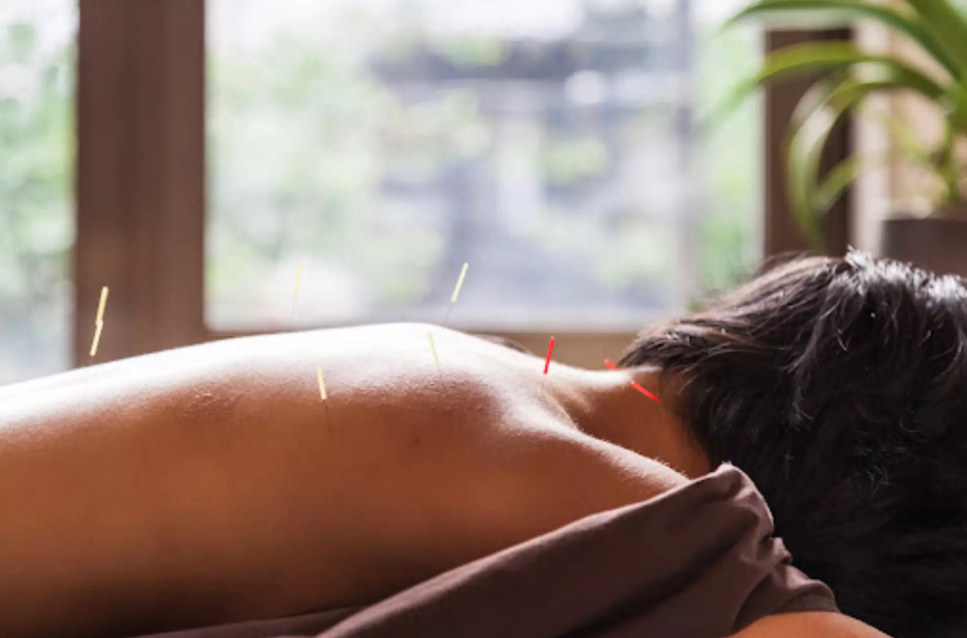 Experience Acupuncture with a Single Session