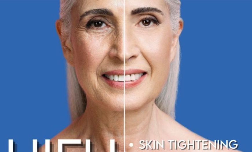 Image 2: Non-Surgical Face, Neck & Stomach Treatment with HIFU Technology 