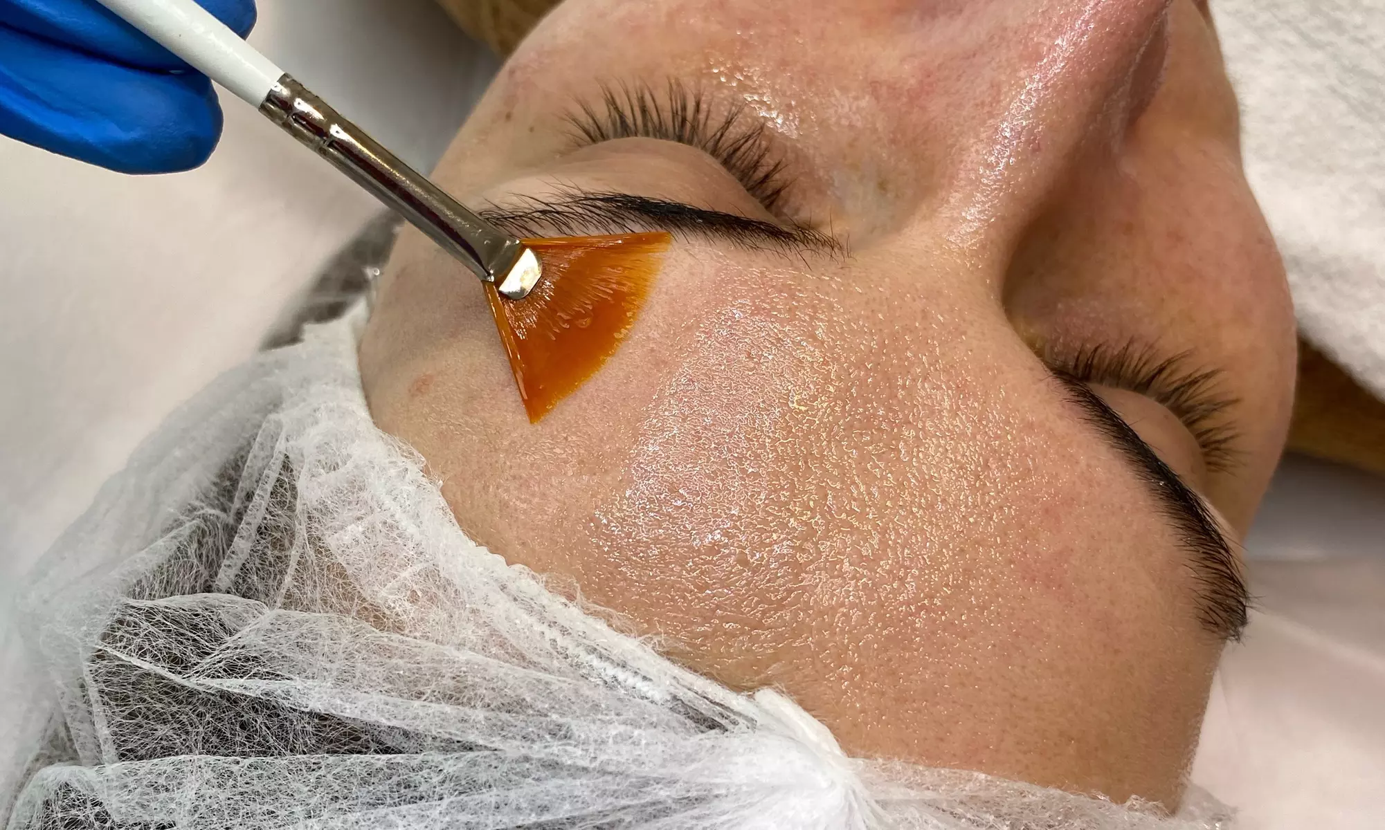 Peeling remodelujący z TCA na twarz i szyję z maską liftingującą