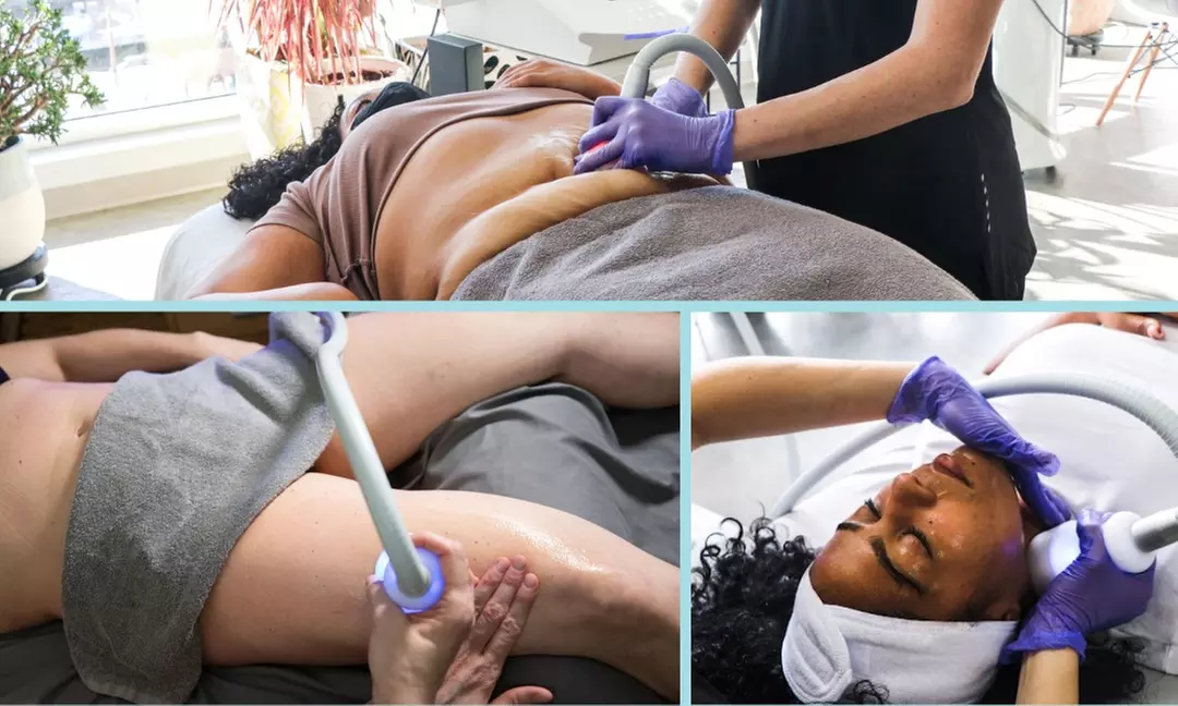 Up to 59% Off on Cryotherapy at Coldfront Cryo - Primary Image