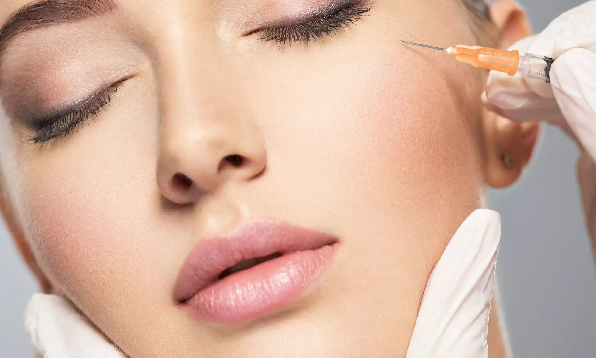 Smooth Out Wrinkles with 50 or 100 Units of Dysport