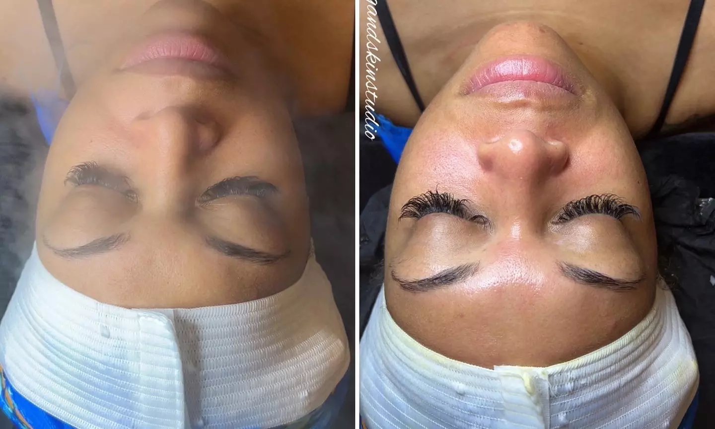 Up to 55% Off on Facial - Chosen by Customer at Queen Waxing and Skin Studio