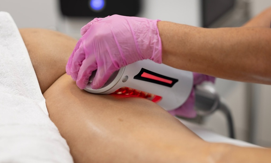 Image 2:  1, 3 or 5  60-Min Body Contour Treatments: Cavitation, RF, & More
