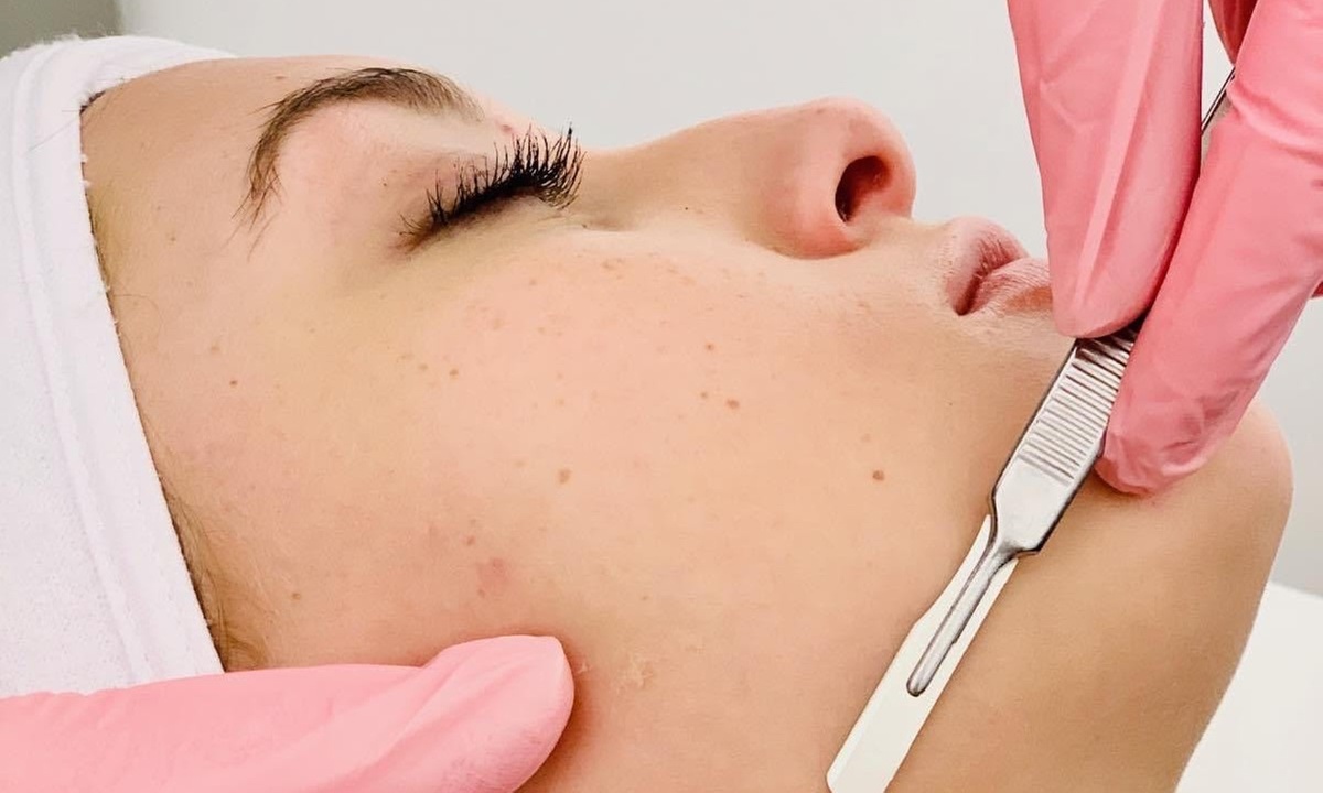Experience Saintly Skin LLC's Dermaplaning Sessions for Radiant Skin with up to 40% Off - Primary Image