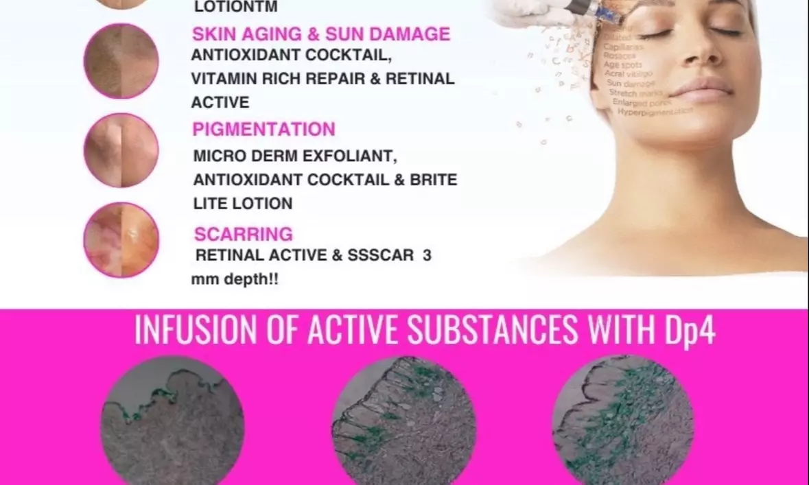 Up to 50% Off on Injection - Botox at Glass Skin Med Spa - Second Medium