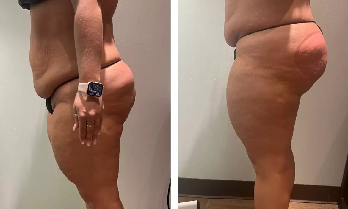 Enjoy up to 47% off at Styled X Kali with options for butt/hip dips sessions of 30 minutes or 1 hour - Primary Image