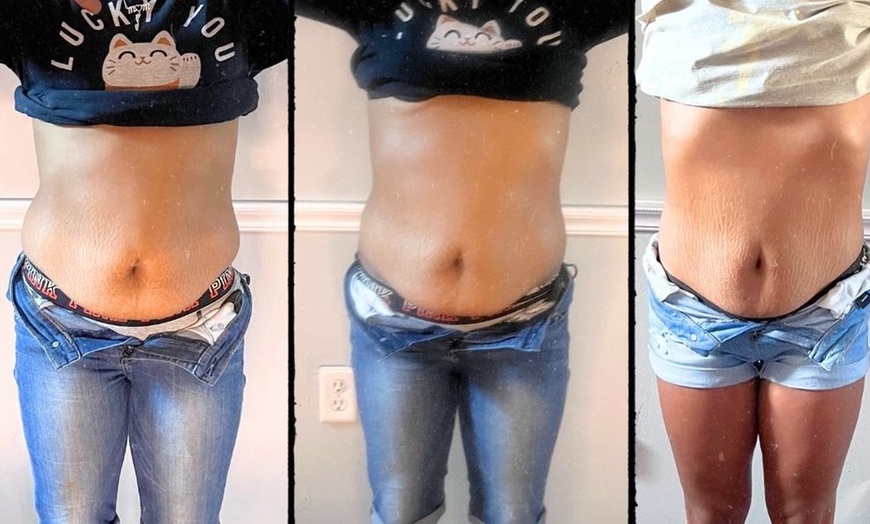 Image 1: Up to 50% Off on Fat Reduction - Non-Branded at Bodiology Esthetic and Contouring