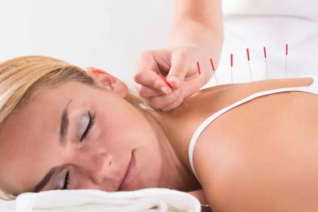 Up to 36% Off on Traditional Chinese Medicine at Beyond Acupuncture - Primary Image