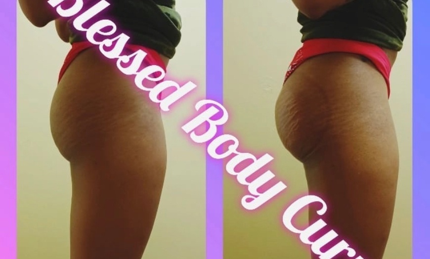 Image 2: Up to 84% Off on Lipo - Non-Invasive Laser-iLipo at Blessed Body Curves