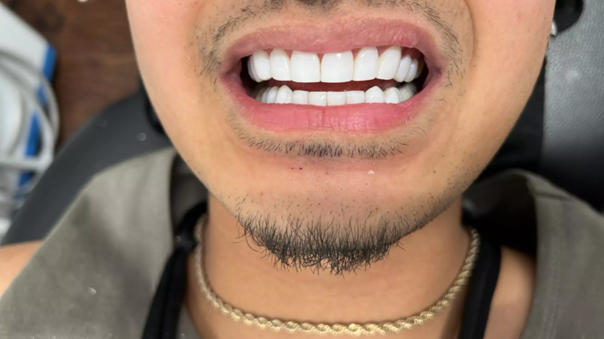 Up to 10% Off on Denture Services at New Smile Cosmetics LLC - Primary Image