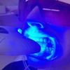 Image 1: Up to 54% Off on Teeth Whitening - In-Office - Non-Branded at Ur Bryte Smile Teeth Whitening