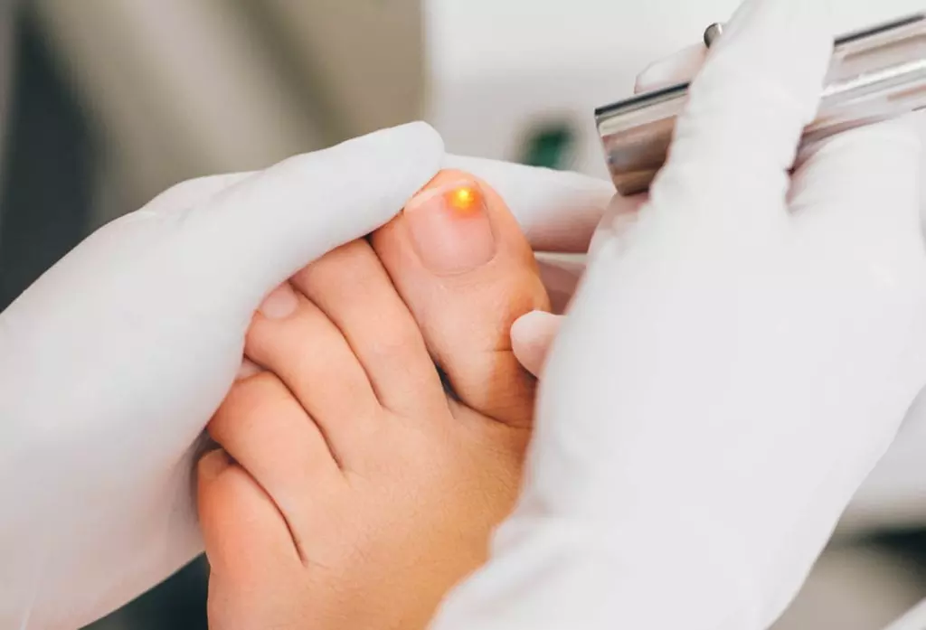 Up to 50% Off on Toe Nail Fungus Laser Removal at Sandals Med Spa - Primary Image