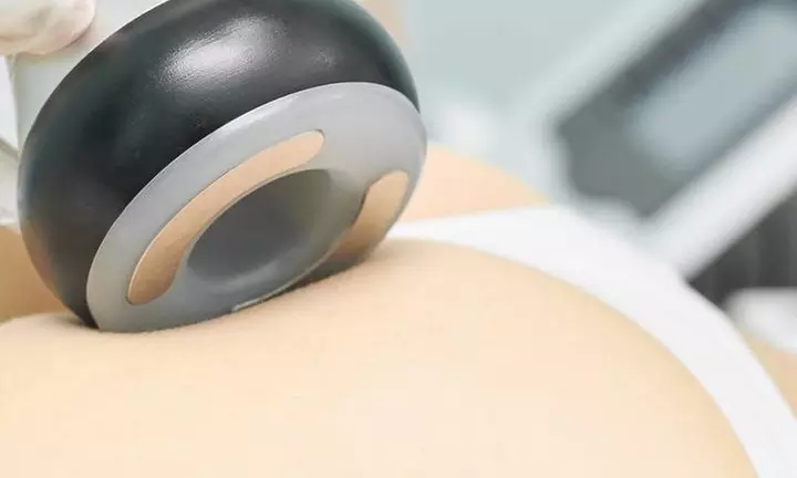 Liposukcja Kawitacyjna, masaż próżniowy z RF lub masaż miodowy