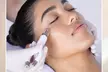 Rejuvenate with 20, 40, or 60 Units Of Xeomin at Revival Med Spa And Salon - Up to 67% Off - Second Medium