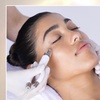 Image 2: Transform with a Syringe of Versa, 3 or 4 Fillers, 1ml or 1ml of RHA