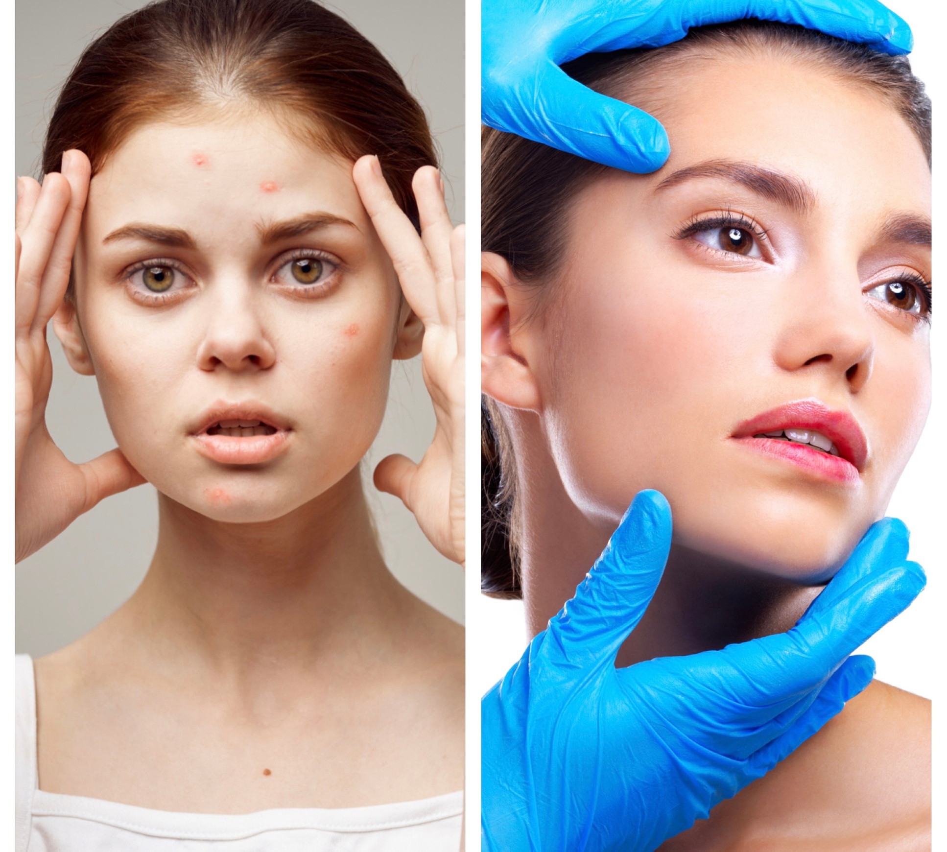 Up to 55% Off on Facial at The Alchemist Skin Bar