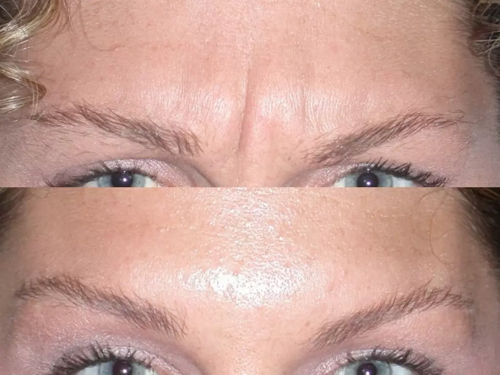 Up to 43% Off on  at Beverley Beauty Clinic - Primary Image