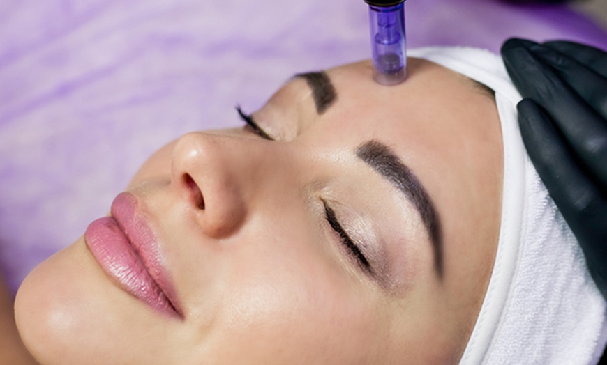 Image 3: Transform your Skin with Face and Neck Microneedling Sessions