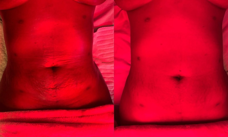 Image 2: Relax with One, Three, or Six 45-Minute Lymphatic Drainage Sessions
