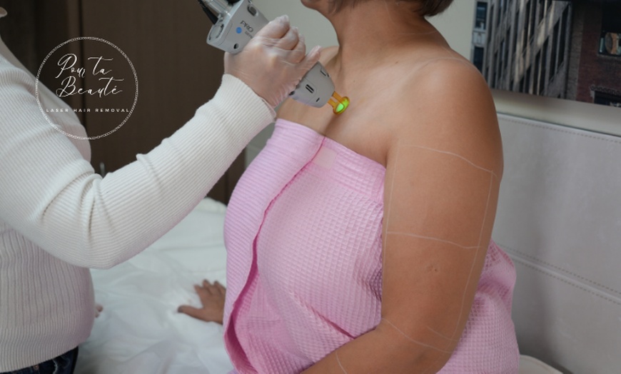 Image 4: Candela GentleMax Pro Laser Hair Removal at Pour Ta Beauté Laser Spa