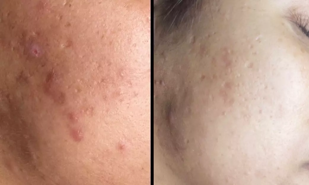 Up to 47% Off on Facial - Chosen by Customer at Drip With Montana - Second Medium