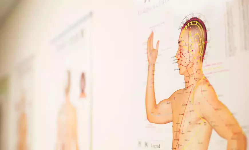 Discover R.A. Acupuncture's session with initial consultation, offering up to 50% off for a unique healing experience - Primary Image