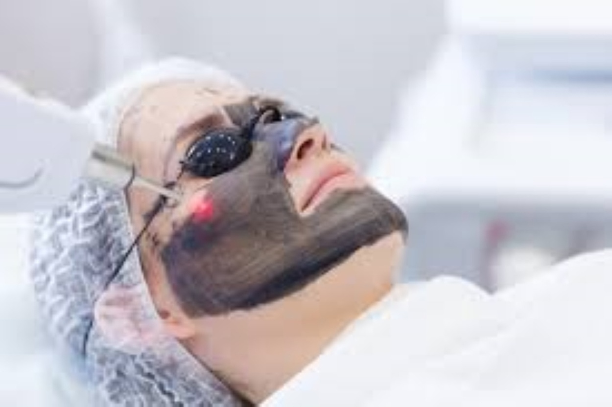 Transform Your Skin with Carbon Laser Resurfacing Options