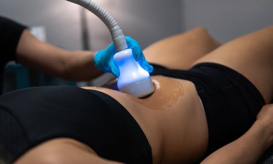 Image 1: Up to 70% Off on  Fat Freezing CRYO T Shock  at FACE FX