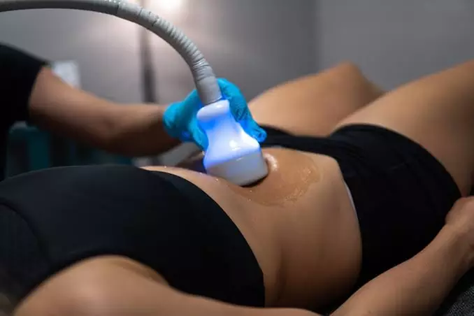 Up to 70% Off on Fat Freezing CRYO Thermal Shock at FACE FX - Primary Image