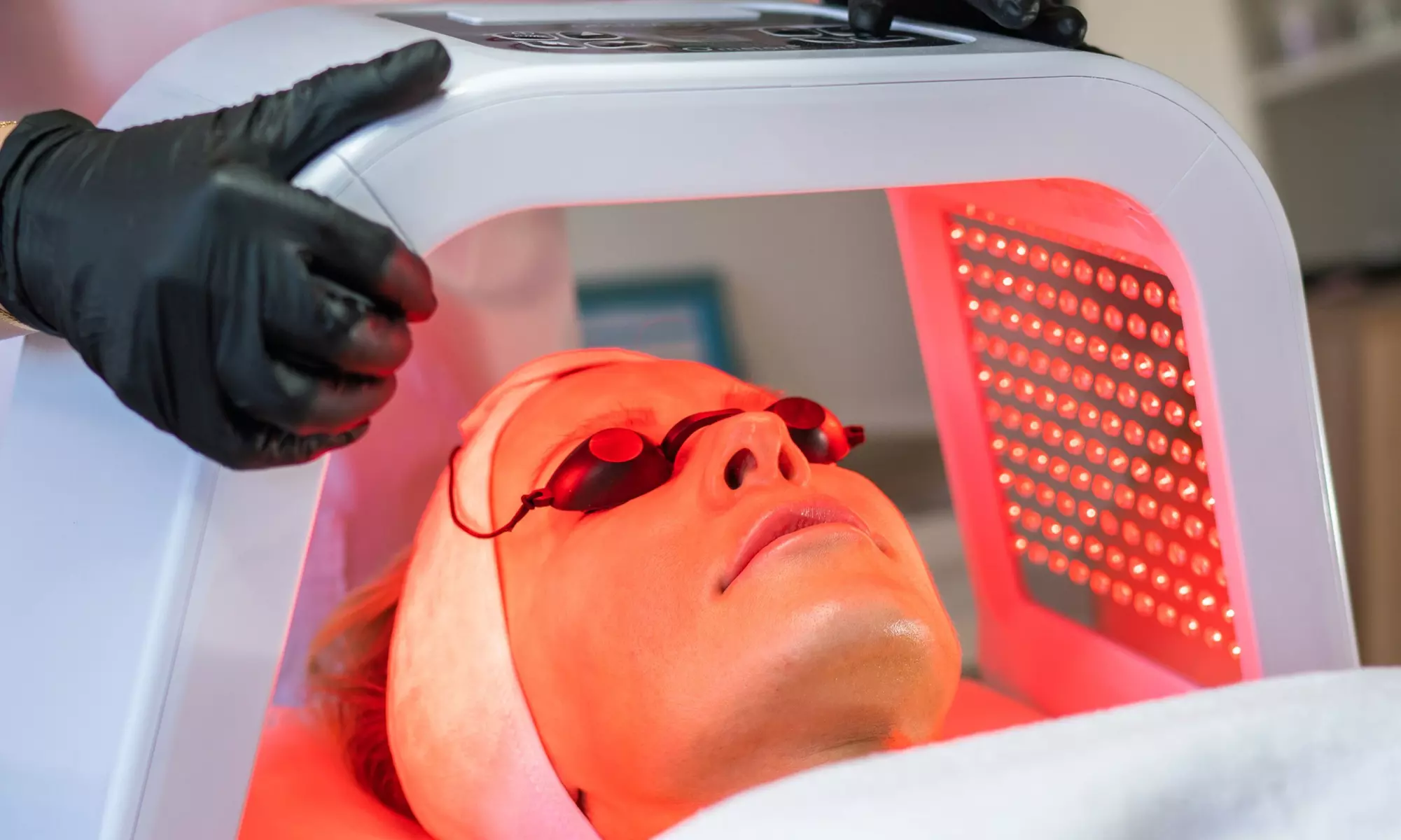 Up to 50% Off on Micro-Needling at Skinethicnyc - Second Medium