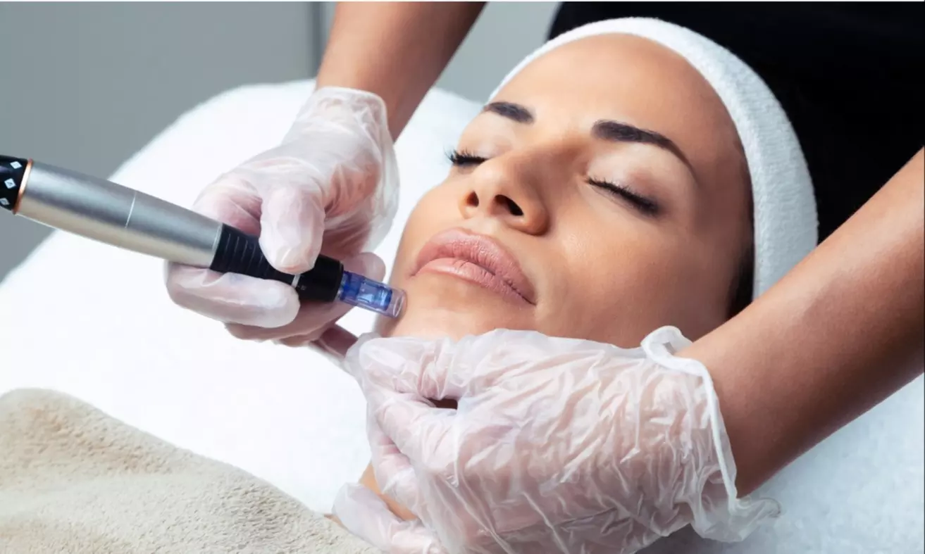 Boost Skin Health with Micro-Needling Sessions