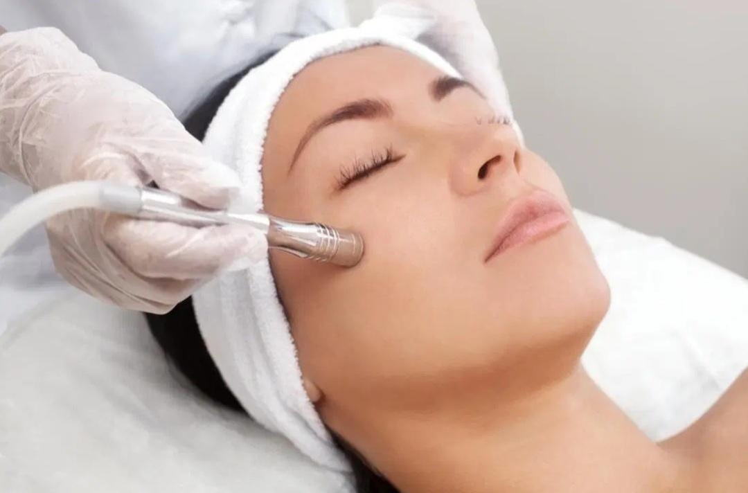 Up to 60% Off on Microdermabrasion at Couture Aesthetics
