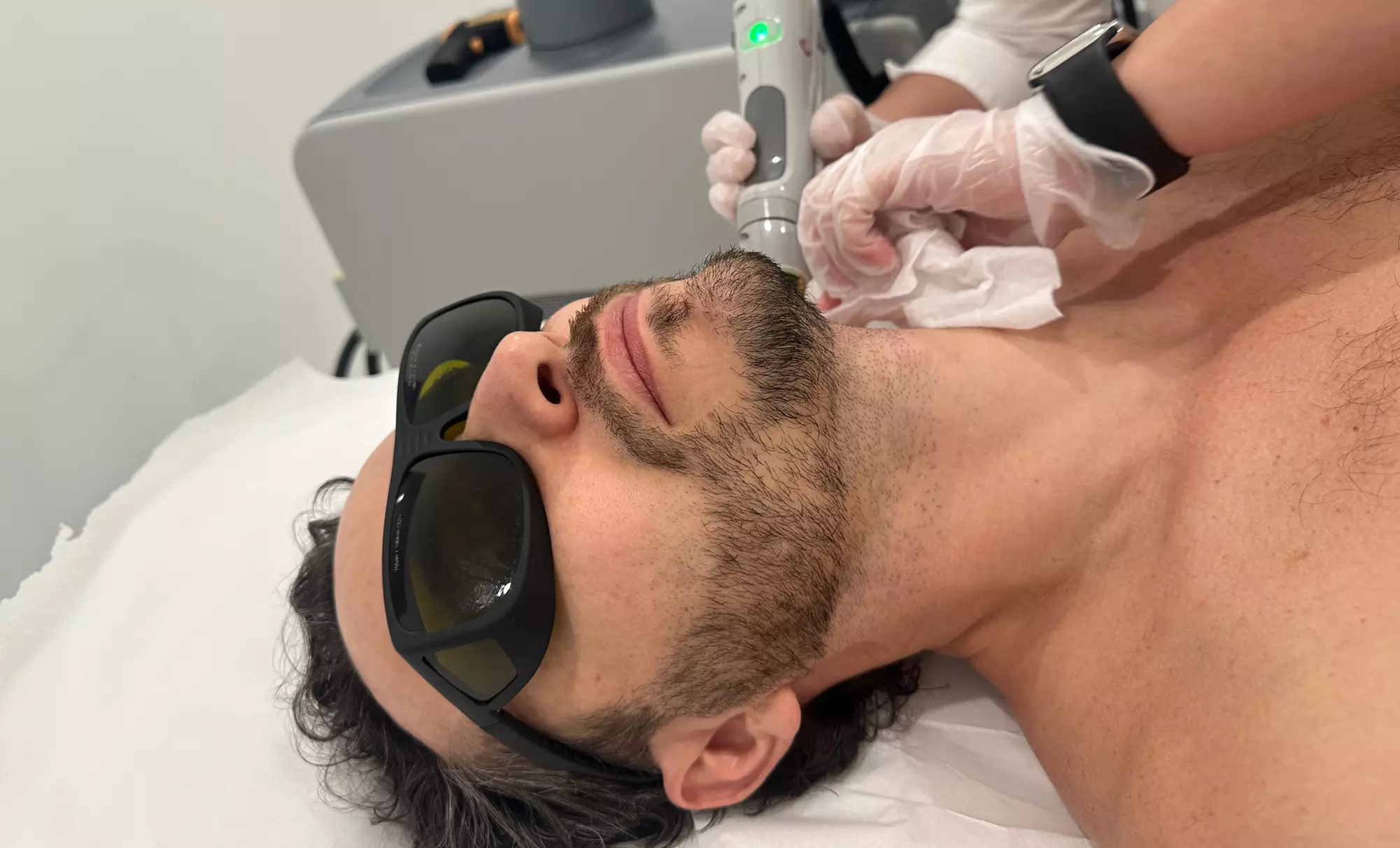 Laser Hair Removal Sessions for Chin, Lip, Neck & More