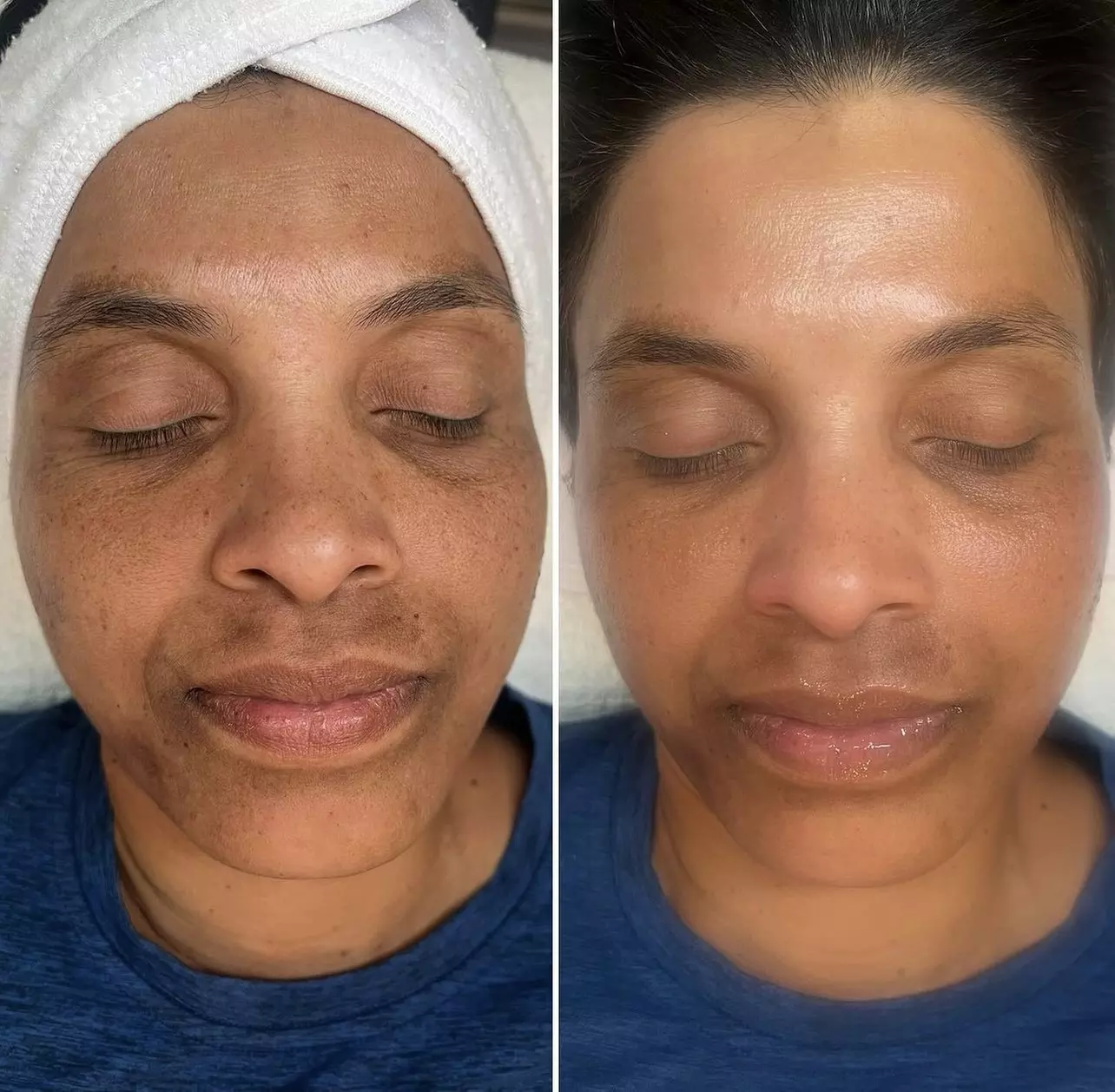 Up to 69% Off on Anti-Aging Facial at AZD Make up & Skin - Primary Image